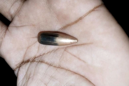 মিয়ানমার থেকে ছোড়া গুলিতে বিদ্ধ টেকনাফের নারী